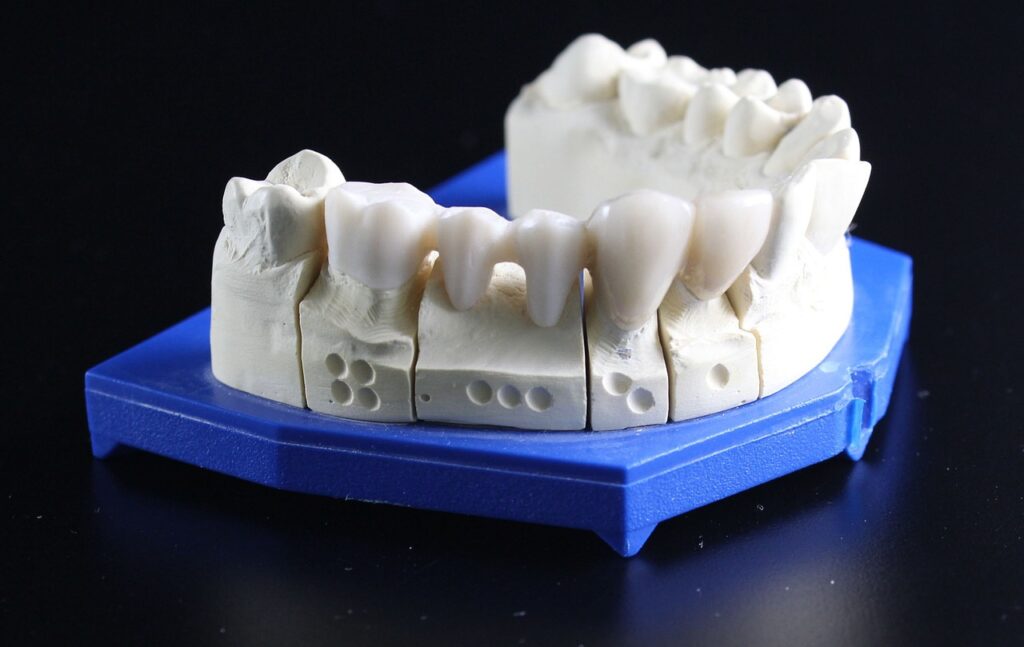 dentures, teeth, dental technician, dentures, dentures, dentures, teeth, teeth, teeth, teeth, teeth, dental technician